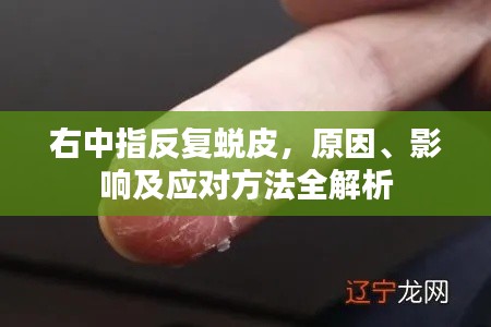右中指反复蜕皮，原因、影响及应对方法全解析